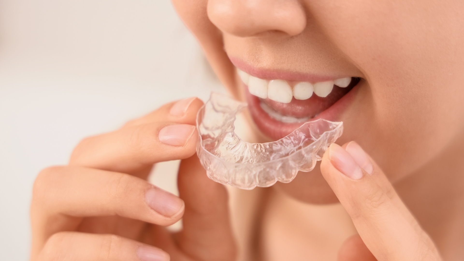 Şeffaf Plak ve Ortodonti Tedavi Merkezi